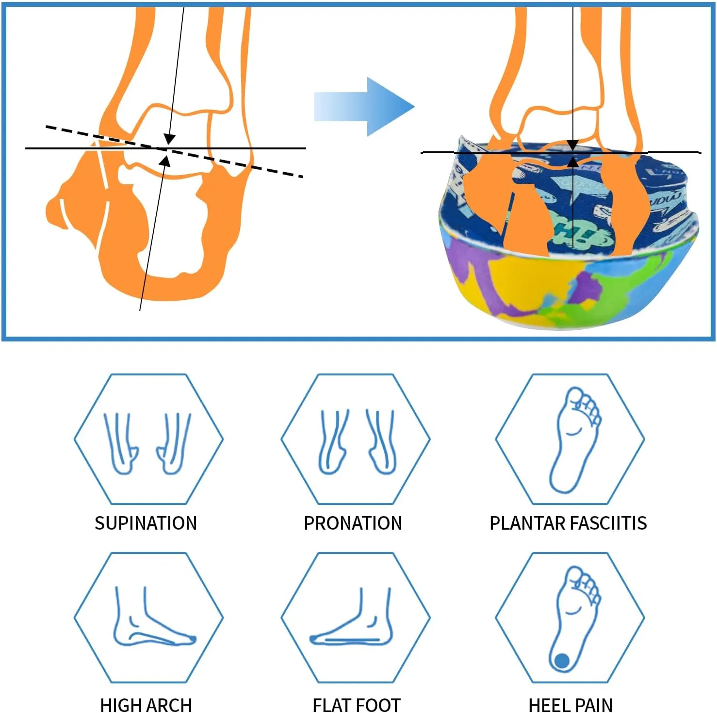 Kids Arch Support Orthotics Plantar Fasciitis Flat Feet Over-Pronation Insoles Relieve Arch, Heel & Ankle Foot Pain Inserts with Heel Cushion (13.5-2M Little Kid, Multicolor)